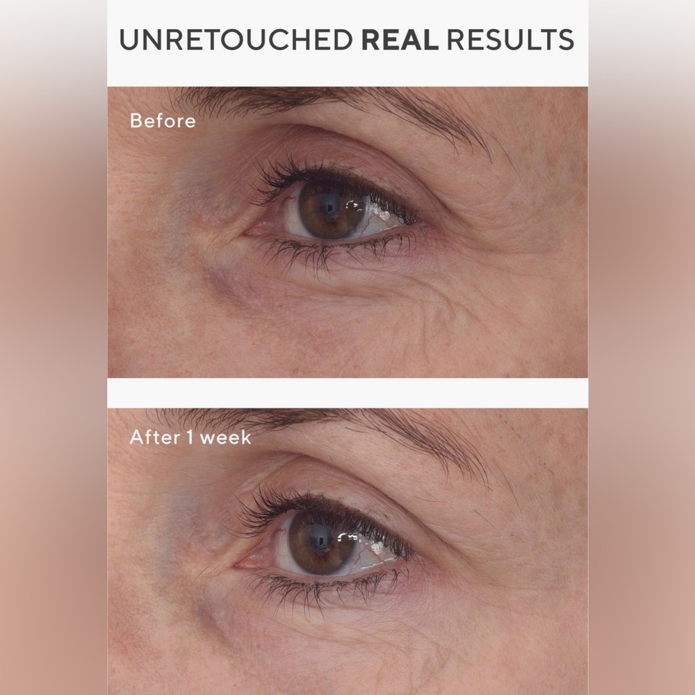 NEW Murad® Retinal Resculpt Eye Lift Treatment, Jade Face Roller & Green Pouch - Picture 5 of 7